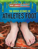 The_Gross_Science_of_Athlete_s_Foot